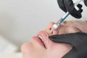 Woman undergoes dermal fillers in new jersey Woman undergoes dermal fillers in new jersey